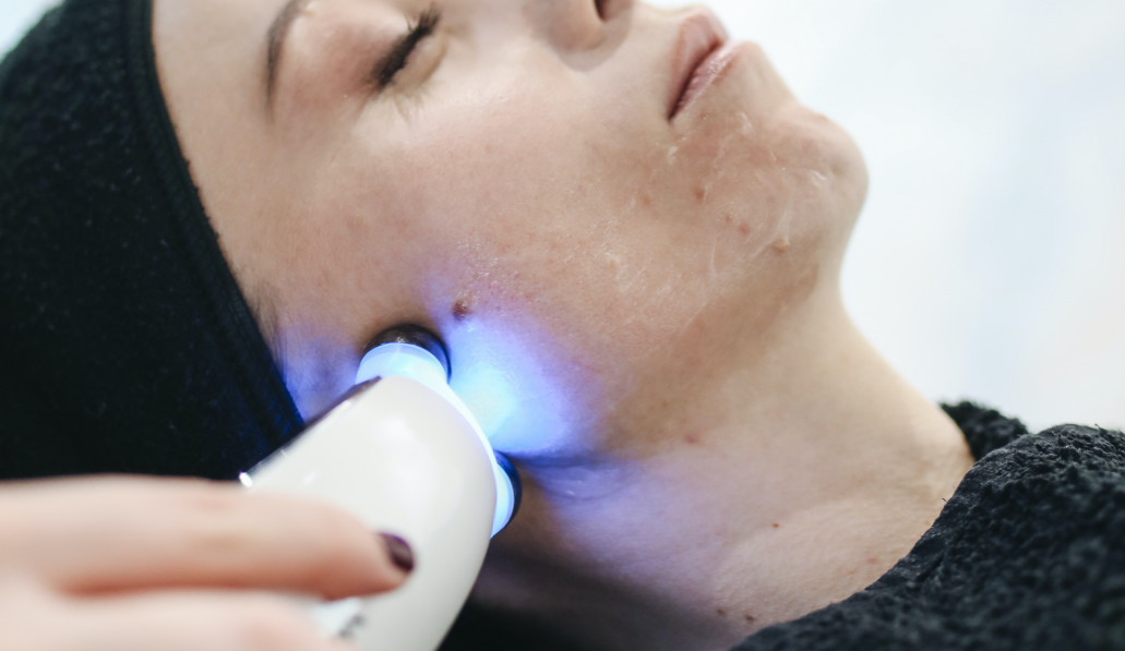 woman's face getting laser treatment